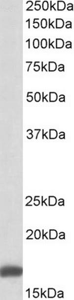 RPS19 Antibody in Western Blot (WB)