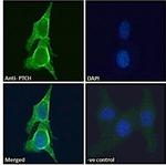 PTCH Antibody in Immunocytochemistry (ICC/IF)