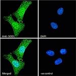 SOD1 Antibody in Immunocytochemistry (ICC/IF)