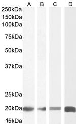 ZNF9 Antibody in Western Blot (WB)