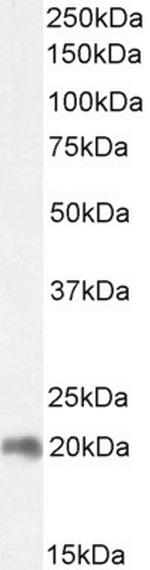 ZNF9 Antibody in Western Blot (WB)