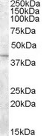 SLC24A5 Antibody in Western Blot (WB)
