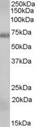 RAD9 Antibody in Western Blot (WB)