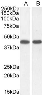 ASS1 Antibody in Western Blot (WB)