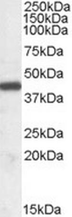 ILF2 Antibody in Western Blot (WB)