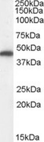 Fumarase Antibody in Western Blot (WB)