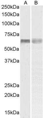 PINK1 Antibody in Western Blot (WB)