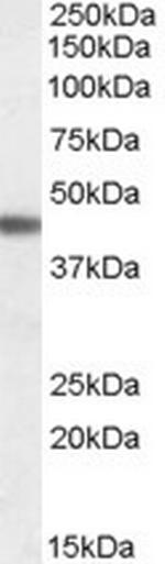 beta-3 Adrenergic Receptor Antibody in Western Blot (WB)