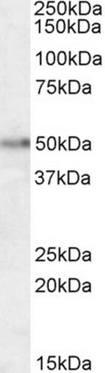 Orexin Receptor 2 Antibody in Western Blot (WB)
