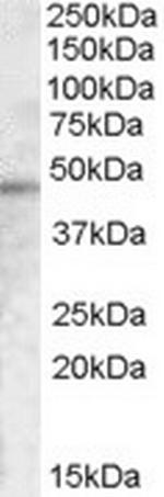 TMPRSS3 Antibody in Western Blot (WB)