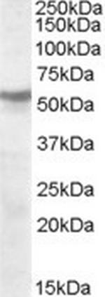 CHRNB1 Antibody in Western Blot (WB)