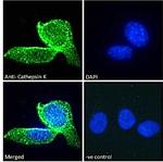 Cathepsin K Antibody in Immunocytochemistry (ICC/IF)