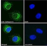 Cathepsin K Antibody in Immunocytochemistry (ICC/IF)