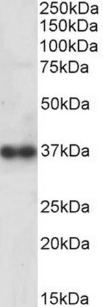Cathepsin K Antibody in Western Blot (WB)