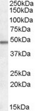 OX1R/OX2R Antibody in Western Blot (WB)