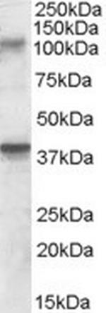 GluR7 Antibody in Western Blot (WB)