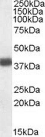 Apolipoprotein L2 Antibody in Western Blot (WB)