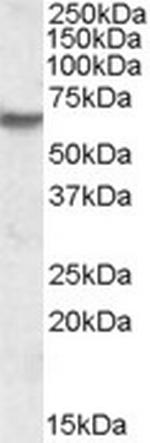 IMPDH2 Antibody in Western Blot (WB)