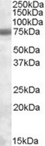 PMSCL1 Antibody in Western Blot (WB)