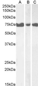 ITPKC Antibody in Western Blot (WB)