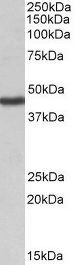 Kir1.1 (KCNJ1) Antibody in Western Blot (WB)