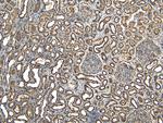 EWSR1 Antibody in Immunohistochemistry (Paraffin) (IHC (P))