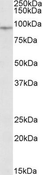 EWSR1 Antibody in Western Blot (WB)