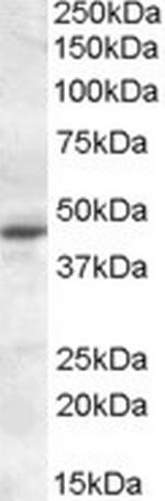 MTNR1A Antibody in Western Blot (WB)
