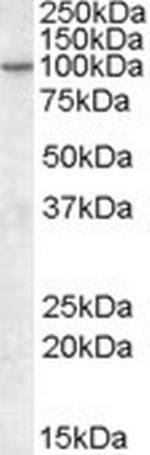 CENTG1 Antibody in Western Blot (WB)