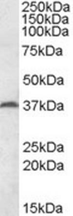 MEST Antibody in Western Blot (WB)