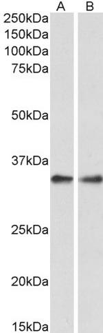 PPP4C Antibody in Western Blot (WB)