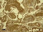 STK39 Antibody in Immunohistochemistry (Paraffin) (IHC (P))