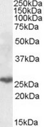 PSMB10 Antibody in Western Blot (WB)