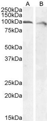 Calnexin Antibody in Western Blot (WB)