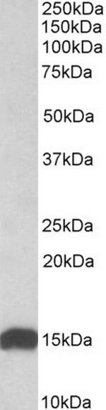 NDUFS6 Antibody in Western Blot (WB)