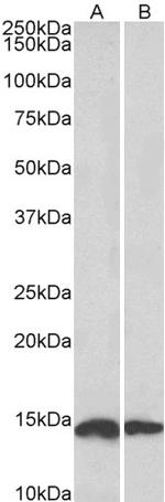 NDUFS6 Antibody in Western Blot (WB)