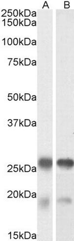 TPPP Antibody in Western Blot (WB)