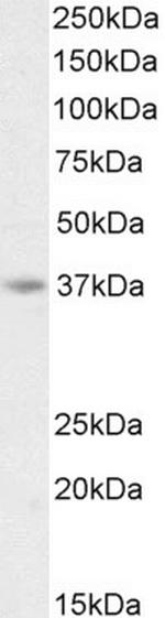 AIM2 Antibody in Western Blot (WB)