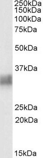 BST-2 Antibody in Western Blot (WB)