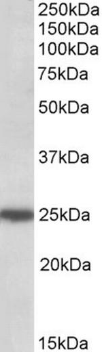 ARHGDIG Antibody in Western Blot (WB)