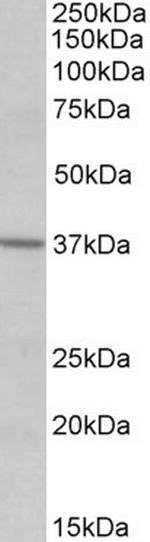 S1PR2 Antibody in Western Blot (WB)