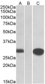 MID1IP1 Antibody in Western Blot (WB)