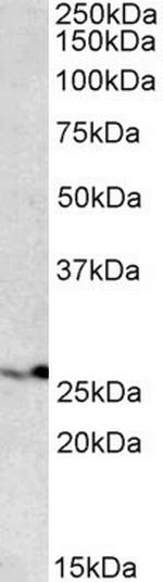 PSMB4 Antibody in Western Blot (WB)