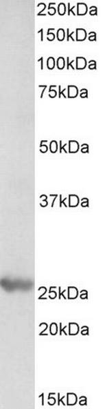 PSMB4 Antibody in Western Blot (WB)