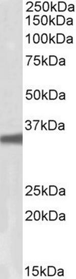 GNB3/GNB4 Antibody in Western Blot (WB)