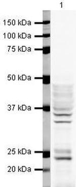 hnRNP A2B1 Antibody in Western Blot (WB)