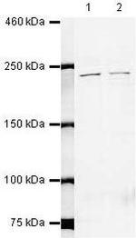 SPT6 Antibody in Western Blot (WB)