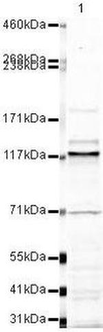 MNAR Antibody in Western Blot (WB)