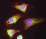 eIF4B Antibody in Immunocytochemistry (ICC/IF)