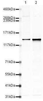 SF3B1 Antibody in Western Blot (WB)